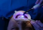 implantes dentales economicos