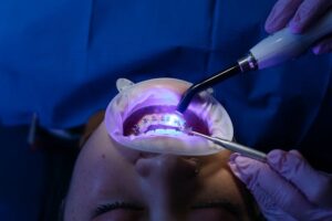 implantes dentales economicos